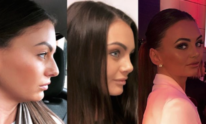 This Love Island star claps back at haters over nose job criticism